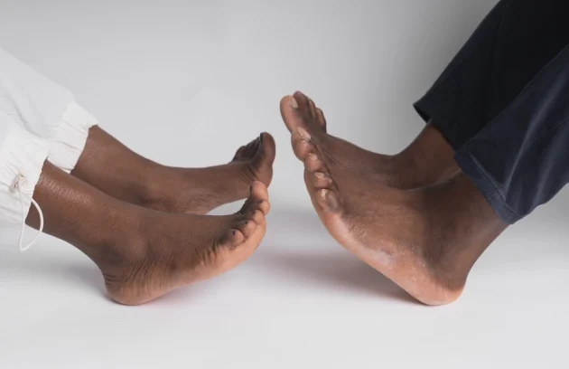 Diabetes and foot problems